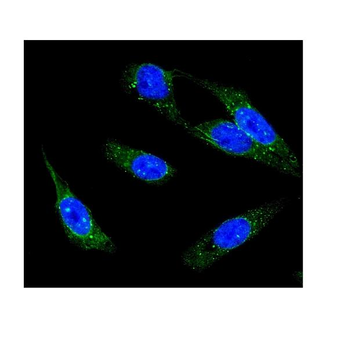 Anti-IP3 receptor/ITPR1 Antibody
