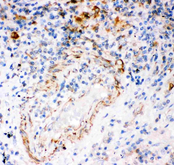 Anti-IP3 receptor/ITPR1 Antibody