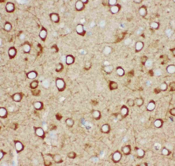 Anti-IP3 receptor/ITPR1 Antibody