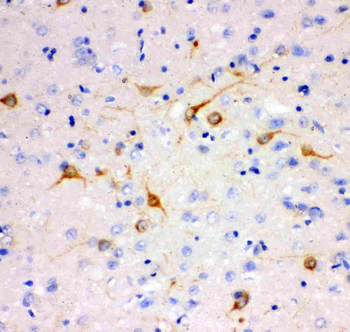 Anti-IP3 receptor/ITPR1 Antibody
