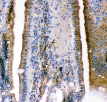 Anti-Maxi Potassium channel alpha/KCNMA1 Antibody