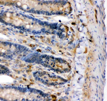 Anti-Maxi Potassium channel alpha/KCNMA1 Antibody