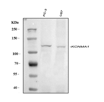 Anti-Maxi Potassium channel alpha/KCNMA1 Antibody