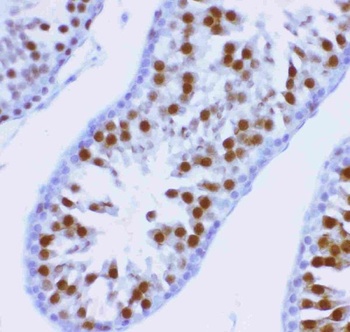 MCAK/KIF2C Antibody