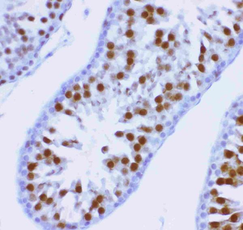 Anti-MCAK/KIF2C Antibody