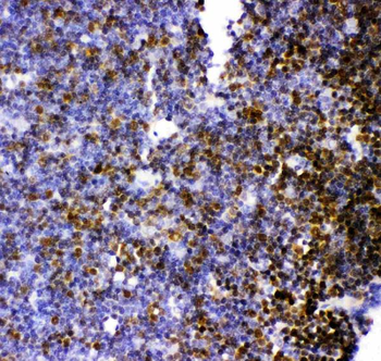 Anti-MCAK/KIF2C Antibody