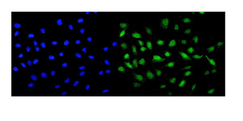 Anti-MCAK/KIF2C Antibody