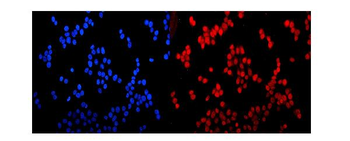 Anti-Glucocorticoid Receptor/NR3C1 Antibody