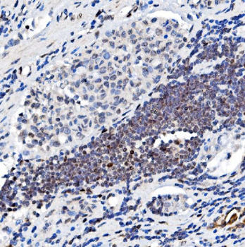 Anti-Glucocorticoid Receptor/NR3C1 Antibody