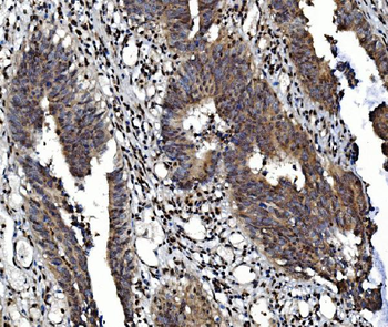 Anti-Glucocorticoid Receptor/NR3C1 Antibody