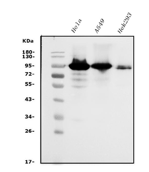 Anti-Glucocorticoid Receptor/NR3C1 Antibody