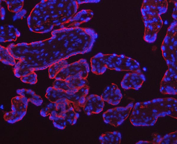 Anti-Transferrin Receptor/TFRC Antibody