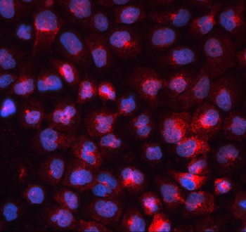 Anti-Transferrin Receptor/TFRC Antibody