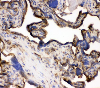 Anti-Transferrin Receptor/TFRC Antibody