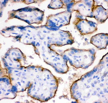 Anti-Transferrin Receptor/TFRC Antibody