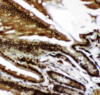 Anti-p73/TP73 Antibody