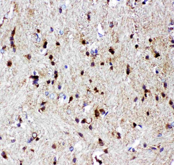 Anti-p73/TP73 Antibody