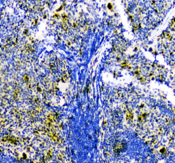 Anti-Smad Interacting Protein 1/ZEB2 Antibody