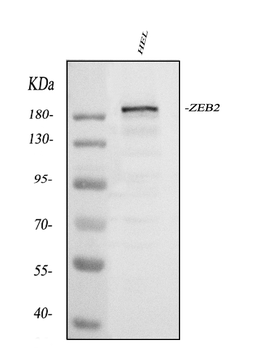 Anti-Smad Interacting Protein 1/ZEB2 Antibody