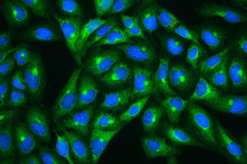 Anti-Hsp27/HSPB1 Antibody