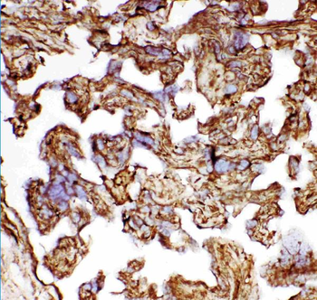 Anti-Hsp27/HSPB1 Antibody