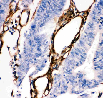 Anti-Hsp27/HSPB1 Antibody
