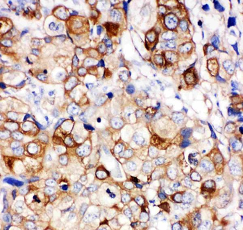 Anti-Hsp27/HSPB1 Antibody