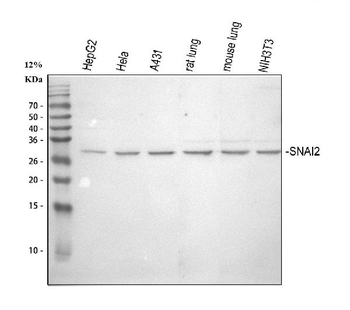 Anti-SLUG/SNAI2 Antibody