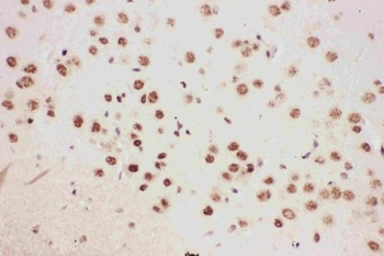 Anti-5 Lipoxygenase/ALOX5 Antibody