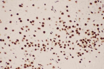 Anti-5 Lipoxygenase/ALOX5 Antibody