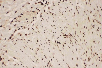 Anti-5 Lipoxygenase/ALOX5 Antibody