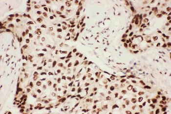 Anti-5 Lipoxygenase/ALOX5 Antibody