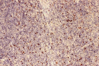 Anti-Forkhead box protein P3 FOXP3 Antibody