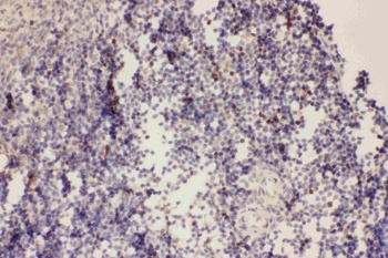 Anti-Forkhead box protein P3 FOXP3 Antibody