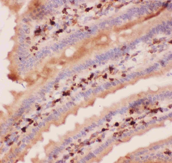 Anti-Angiopoietin 2/ANGPT2 Antibody
