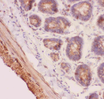 Anti-Angiopoietin 2/ANGPT2 Antibody
