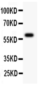 Serine-protein kinase ATM ATM Rabbit Polyclonal Antibody