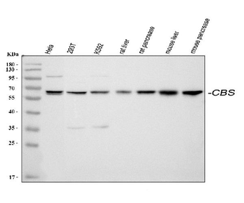 Anti-Cystathionine beta-synthase CBS Antibody