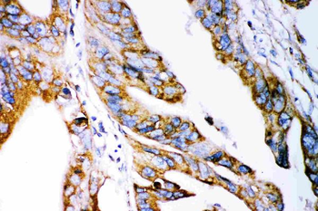 Claudin 2/CLDN2 Rabbit Polyclonal Antibody