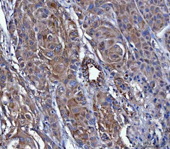 Anti-Dicer/DICER1 Antibody