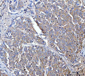 Anti-Dicer/DICER1 Antibody