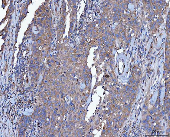 Anti-Dicer/DICER1 Antibody