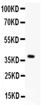 MBD2 Rabbit Polyclonal Antibody