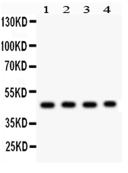 MBD2 Rabbit Polyclonal Antibody