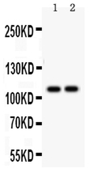 Anti-SERCA1 ATPase/ATP2A1 Antibody