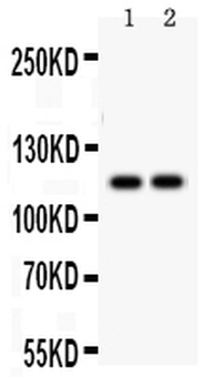 SERCA3 ATPase/ATP2A3 Antibody