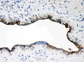 Anti-Occludin/OCLN Antibody