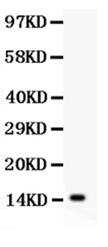 Anti-TNF alpha Antibody