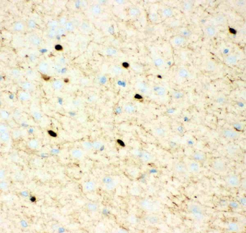 Anti-Calretinin/CALB2 Antibody