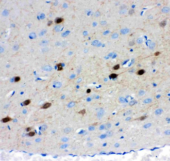 Anti-Calretinin/CALB2 Antibody